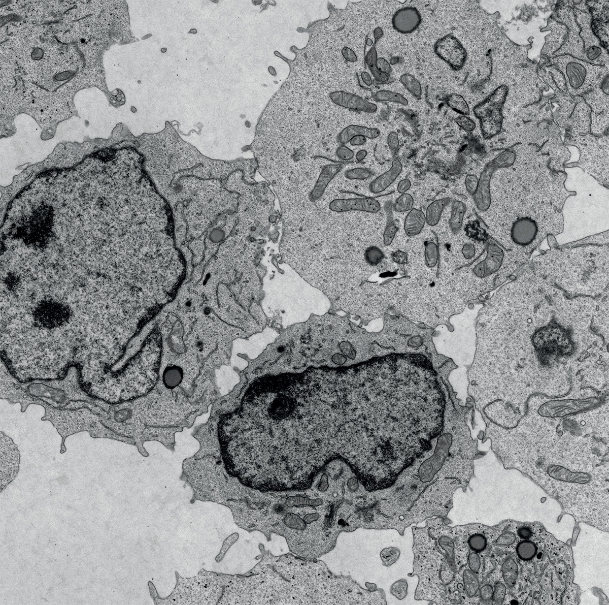 Electron microscopy of T cells treated with PGE2, causing lipid droplet accumulation.